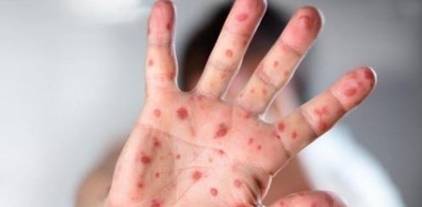  ������ ���� ��������������� ������� �������� 