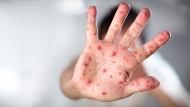  ������� ������� ����� 