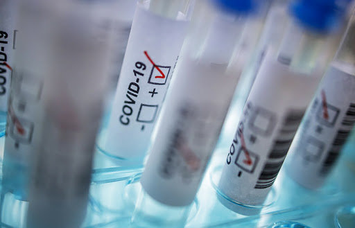  �������� ����� ��������������� ������ covid-19 